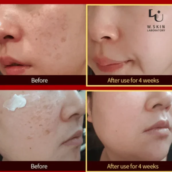 W.Skin Laboratory A.M Cream (Anti-Melasma) 50ml - Image 3