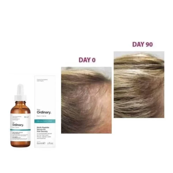 The Ordinary Multi-Peptide Hair Serum for Hair Density (60ml) - Image 3