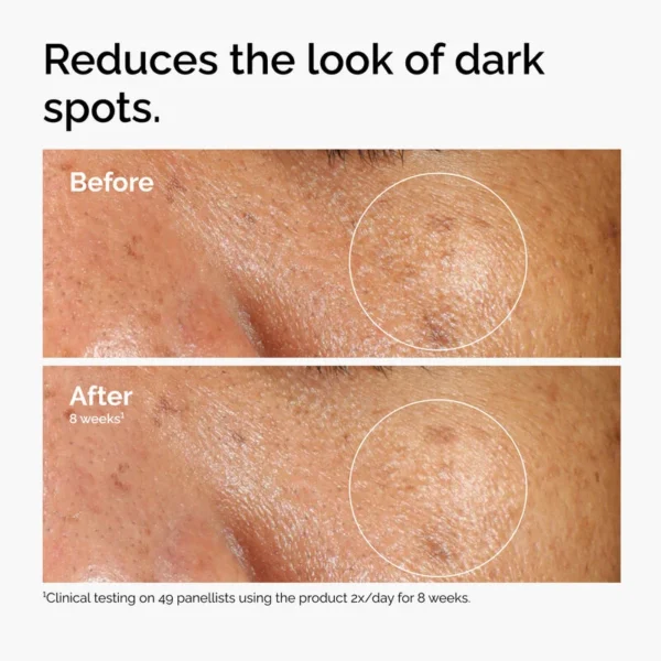The Ordinary Alpha Arbutin 2% + HA 30ml - Image 4